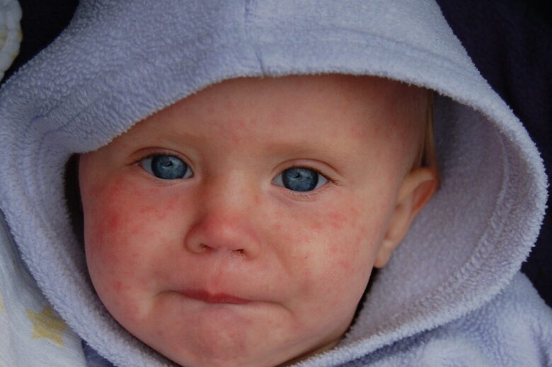 Close-up of a baby with a hooded towel wrapped around the head, looking at the camera.